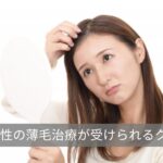 上野でおすすめ女性の薄毛治療